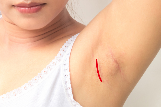 あの巨乳のオッパイは本物・偽物?豊胸手術の偽乳を見分ける方法!